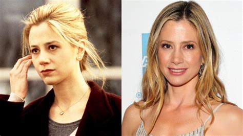 mira sorvino breasts|Mira Sorvinos Plastic Surgery: Before and After Transformation。